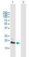 Guanylate Cyclase Activator 1C antibody, H00009626-B01P, Novus Biologicals, Western Blot image 