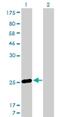 Membrane Spanning 4-Domains A7 antibody, H00058475-M06, Novus Biologicals, Western Blot image 