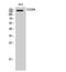 Mannose Receptor C-Type 1 antibody, A02285, Boster Biological Technology, Western Blot image 