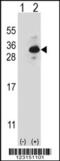 Clathrin Light Chain B antibody, 56-738, ProSci, Western Blot image 