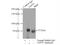 Centrosomal Protein 72 antibody, 19928-1-AP, Proteintech Group, Immunoprecipitation image 