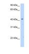 Solute Carrier Family 25 Member 24 antibody, NBP1-60063, Novus Biologicals, Western Blot image 