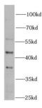 Bleomycin Hydrolase antibody, FNab00907, FineTest, Western Blot image 