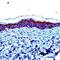 Involucrin antibody, PA1-37934, Invitrogen Antibodies, Immunohistochemistry paraffin image 
