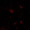 Zinc Finger And BTB Domain Containing 6 antibody, NBP1-76519, Novus Biologicals, Immunofluorescence image 