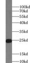 Zinc Finger Matrin-Type 2 antibody, FNab09647, FineTest, Western Blot image 