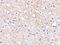 Plexin Domain Containing 2 antibody, A08798, Boster Biological Technology, Immunohistochemistry paraffin image 