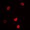 L3MBTL Histone Methyl-Lysine Binding Protein 3 antibody, orb341266, Biorbyt, Immunofluorescence image 