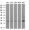 Potassium Voltage-Gated Channel Interacting Protein 2 antibody, MA5-26866, Invitrogen Antibodies, Western Blot image 