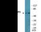 Dihydropyrimidinase Like 2 antibody, EKC2611, Boster Biological Technology, Western Blot image 