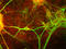 Myristoylated Alanine Rich Protein Kinase C Substrate antibody, LS-C204535, Lifespan Biosciences, Immunocytochemistry image 