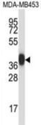 Serine Protease 8 antibody, abx027878, Abbexa, Western Blot image 