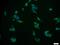 Purinergic Receptor P2X 7 antibody, 11144-1-AP, Proteintech Group, Immunofluorescence image 