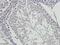 Regulator Of Calcineurin 1 antibody, orb55855, Biorbyt, Immunohistochemistry paraffin image 