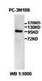 Alkaline Ceramidase 3 antibody, orb77489, Biorbyt, Western Blot image 