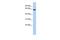 Coiled-Coil Domain Containing 96 antibody, GTX45244, GeneTex, Western Blot image 