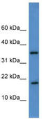 Transcription Elongation Factor A Like 9 antibody, TA345199, Origene, Western Blot image 