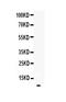 Epidermal Growth Factor antibody, A00378-1, Boster Biological Technology, Western Blot image 