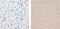Nuclear Receptor Subfamily 3 Group C Member 1 antibody, MA5-15801, Invitrogen Antibodies, Immunohistochemistry paraffin image 