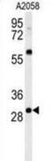 Glutathione S-Transferase Omega 2 antibody, abx032633, Abbexa, Immunofluorescence image 