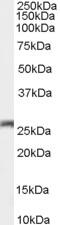 Adaptor Protein, Phosphotyrosine Interacting With PH Domain And Leucine Zipper 1 antibody, 45-271, ProSci, Western Blot image 