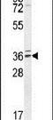 Tubulin Polyglutamylase Complex Subunit 2 antibody, PA5-24031, Invitrogen Antibodies, Western Blot image 