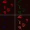 Gsdmc1 antibody, GTX03667, GeneTex, Immunocytochemistry image 