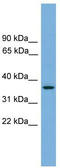 G Protein-Coupled Receptor 27 antibody, TA342542, Origene, Western Blot image 
