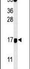 Fibroblast Growth Factor Binding Protein 3 antibody, PA5-25539, Invitrogen Antibodies, Western Blot image 