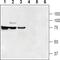 Solute Carrier Family 47 Member 1 antibody, PA5-77554, Invitrogen Antibodies, Western Blot image 