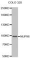 Nucleoporin 98 antibody, abx000745, Abbexa, Western Blot image 