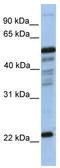 Hematopoietic Prostaglandin D Synthase antibody, TA346773, Origene, Western Blot image 