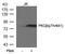 Protein Kinase C Beta antibody, PA5-37692, Invitrogen Antibodies, Western Blot image 