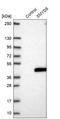 SMYD Family Member 5 antibody, HPA049002, Atlas Antibodies, Western Blot image 