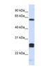 Hyaluronan Binding Protein 2 antibody, NBP1-59163, Novus Biologicals, Western Blot image 