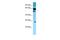 Solute Carrier Family 22 Member 9 antibody, A08762, Boster Biological Technology, Western Blot image 