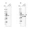 Phosphoglycerate Dehydrogenase antibody, NBP1-87311, Novus Biologicals, Western Blot image 