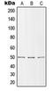 Solute Carrier Family 39 Member 7 antibody, LS-C353024, Lifespan Biosciences, Western Blot image 