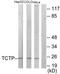 Fortilin antibody, TA314640, Origene, Western Blot image 