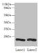 Charged multivesicular body protein 2a antibody, LS-B11387, Lifespan Biosciences, Western Blot image 