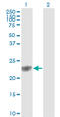 Glutathione S-Transferase Pi 1 antibody, LS-C197370, Lifespan Biosciences, Western Blot image 