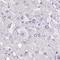 Ankyrin Repeat Domain 45 antibody, NBP1-85423, Novus Biologicals, Immunohistochemistry paraffin image 