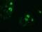 Zinc Finger Imprinted 2 antibody, GTX83403, GeneTex, Immunofluorescence image 
