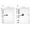 Acyl-CoA Thioesterase 7 antibody, NBP1-89278, Novus Biologicals, Western Blot image 