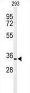 Prohibitin 2 antibody, abx033286, Abbexa, Immunohistochemistry paraffin image 