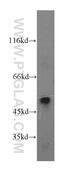 StAR-related lipid transfer protein 3 antibody, 20292-1-AP, Proteintech Group, Western Blot image 