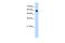 SWI/SNF Related, Matrix Associated, Actin Dependent Regulator Of Chromatin, Subfamily D, Member 2 antibody, PA5-41441, Invitrogen Antibodies, Western Blot image 