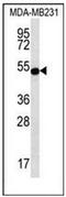 Signal Transducing Adaptor Family Member 2 antibody, AP54064PU-N, Origene, Western Blot image 