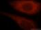 Thymidine Kinase 1 antibody, 15691-1-AP, Proteintech Group, Immunofluorescence image 