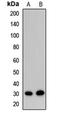 Exosome complex exonuclease RRP43 antibody, LS-C668143, Lifespan Biosciences, Western Blot image 